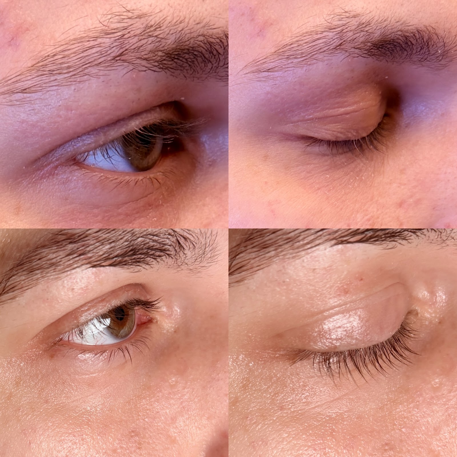 TO BEAUTY – Ergebnis einer Behandlung